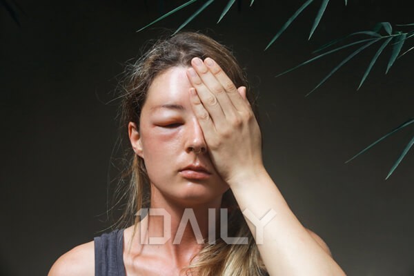 데일리 - 나도 모르게 몸이 붓는 '의외의' 이유 건강 몸붓기,몸,붓기,부기,부기원인,붓기원인,부종,부종원인,붓기빼기,겨드랑이부종 데일리 - 나도 모르게 몸이 붓는 '의외의' 이유 건강 몸붓기,몸,붓기,부기,부기원인,붓기원인,부종,부종원인,붓기빼기,겨드랑이부종