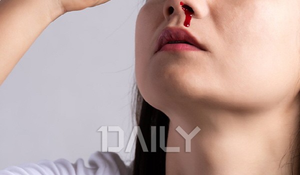 데일리 - 별 이유 없이 추운 날 코피 난다면 '이것' 의심 건강 코피,겨울코피,코피원인,코피이유,코피나는이유,코건조,코세척 ...